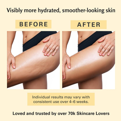 Anti Cellulite Massage Oil